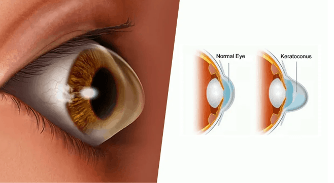 Comprehensive Eye Examination